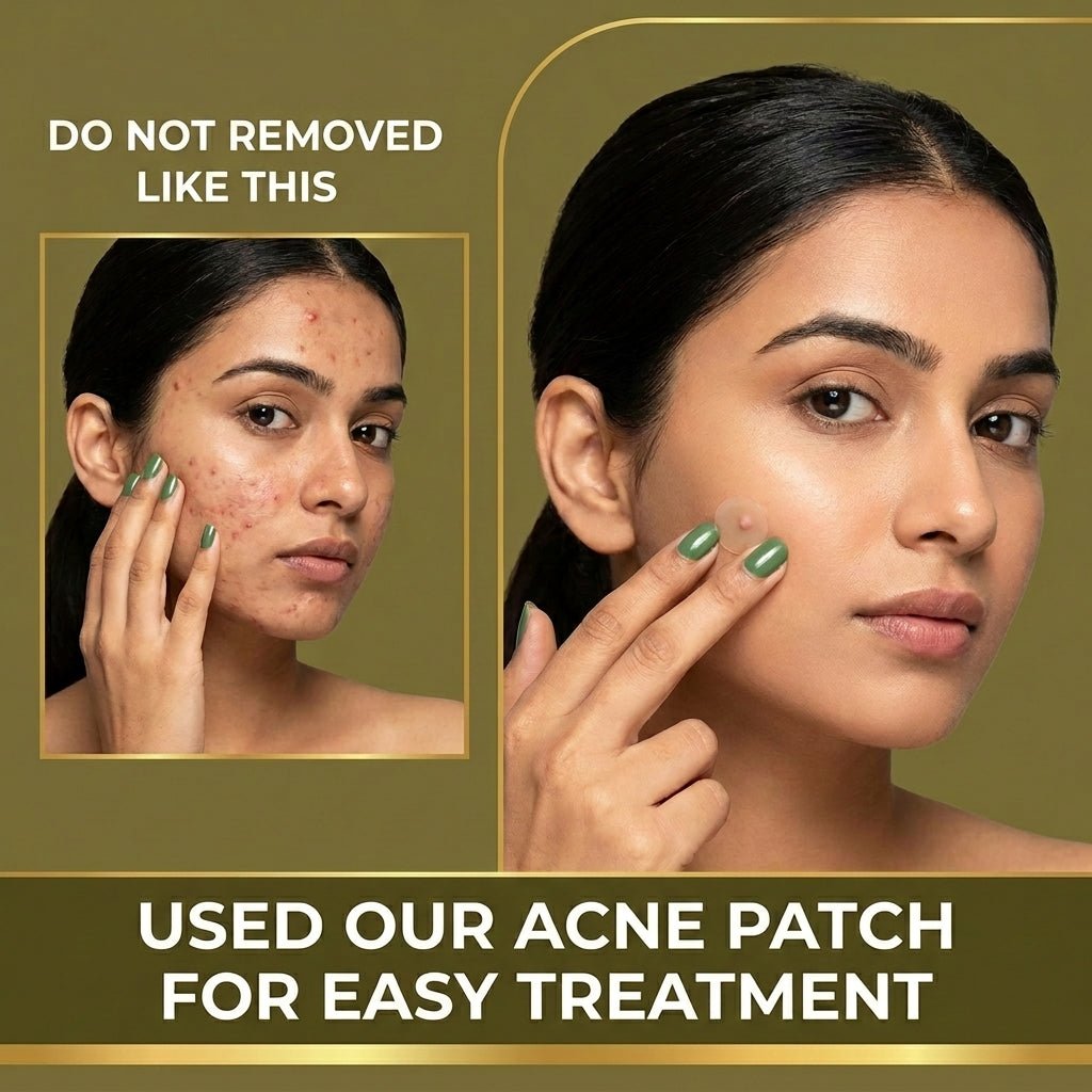 Acne Clearing Pimple Patches (Pack of 2) | 144 Hydrocolloid Acne Spot Patches for All Skin Types