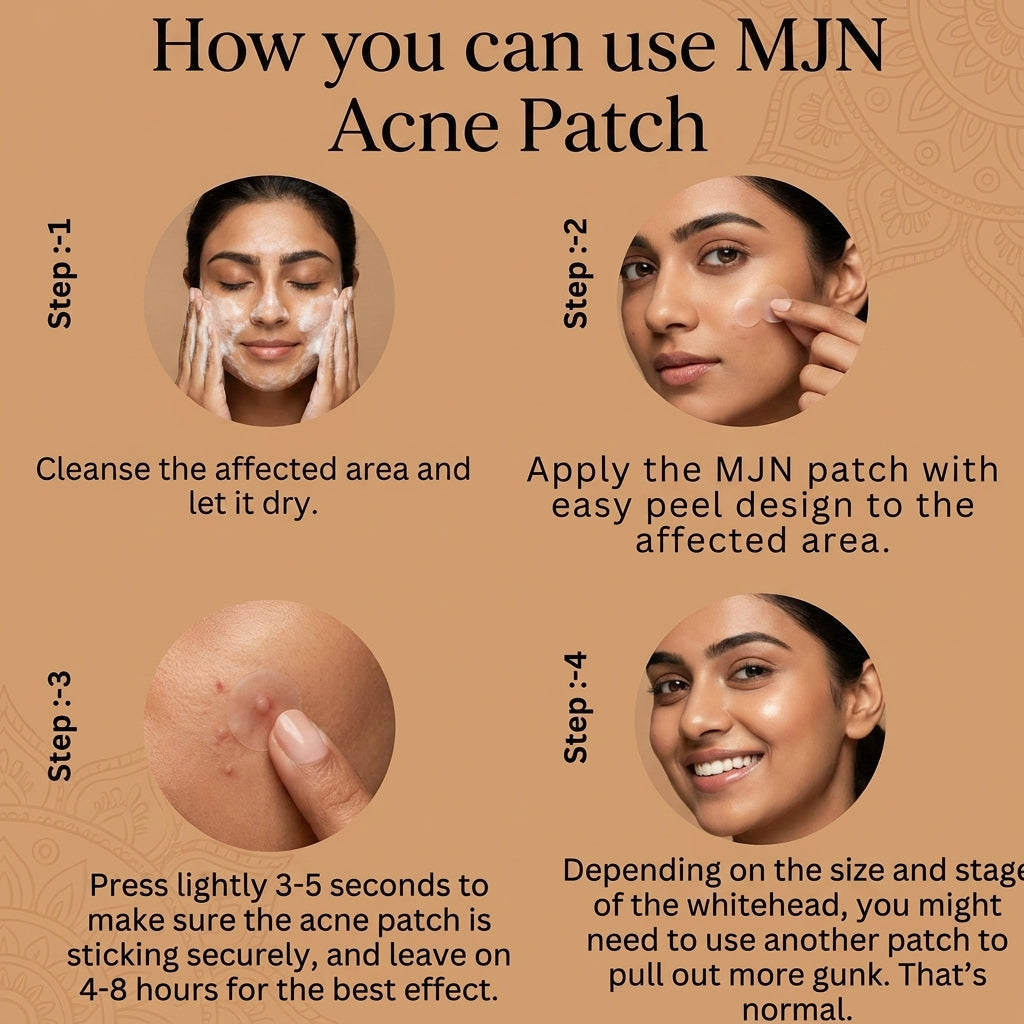 Acne Clearing Pimple Patches (Pack of 2) | 144 Hydrocolloid Acne Spot Patches for All Skin Types